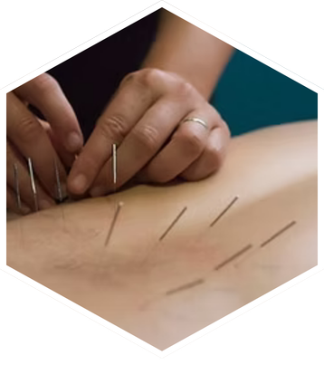 Polaris Physiotherapy